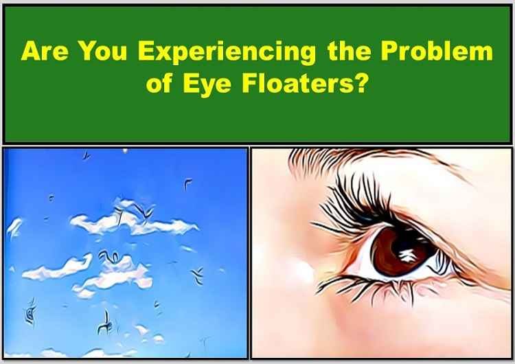 Wavy Squiggly Lines in Vision, Floaters: Causes, Treatment 3 eye-floaters-wavy-squiggly-lines-in-vision
