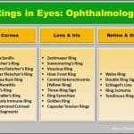 rings in eyes rings in ophthalmology farsightedness