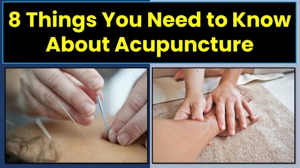 8 Things You Need to Know About Acupuncture 3 8-things-you-need-to-know-about-acupuncture