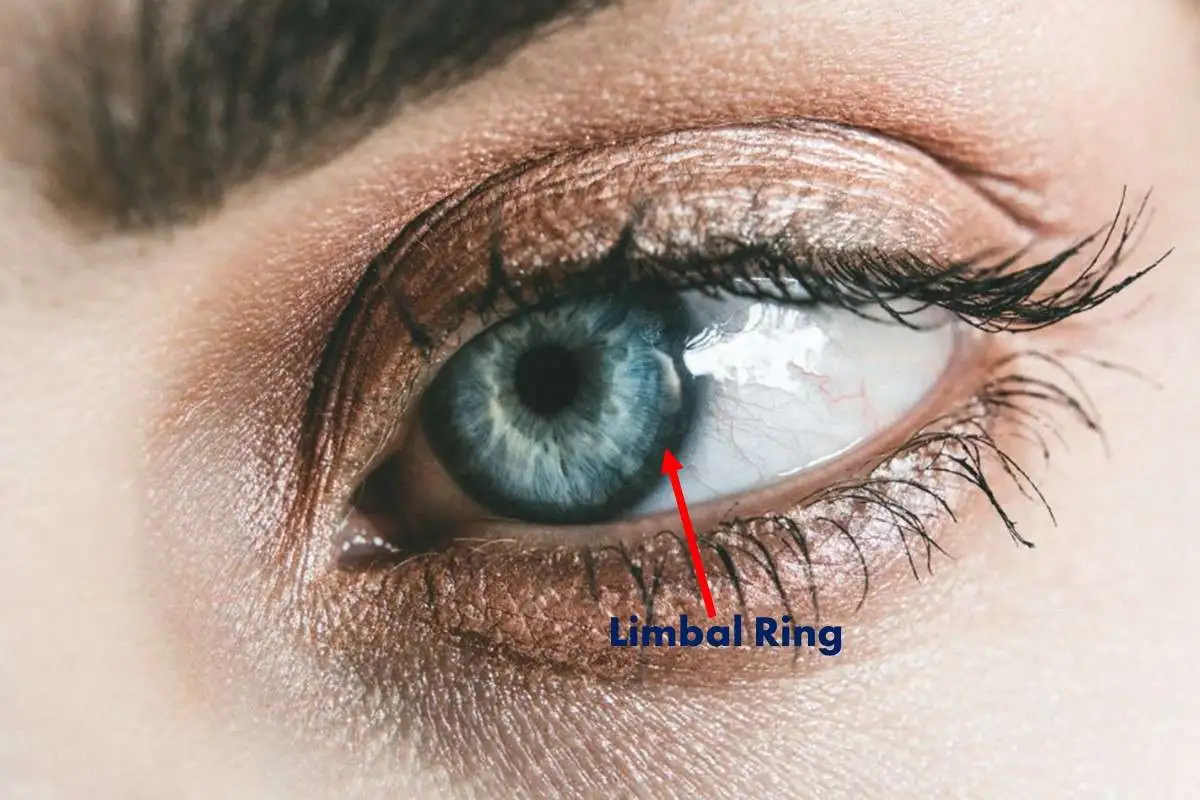 black-dark-limbal-ring-spiritual-meaning-around-the-iris