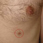 third breast third nipple spiritual meaning power mythology causes removal knee pain spiritual meaning