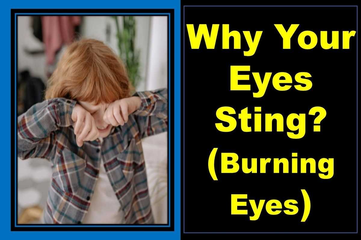 burning-eyes-sting-causes-treatment