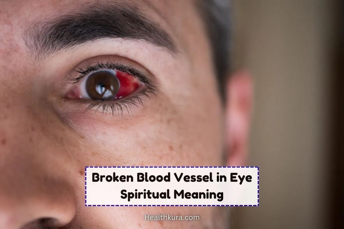 broken-blood-vessel-in-the-eye-spiritual-meaning-myth