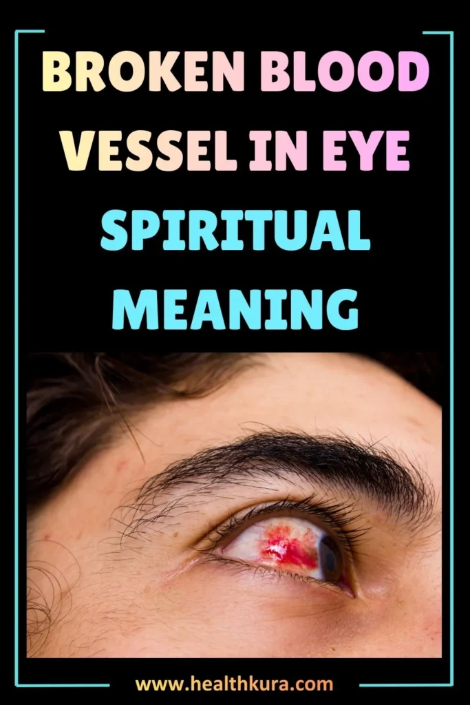 spiritual-meaning-of-broken-blood-vessel-in-eye